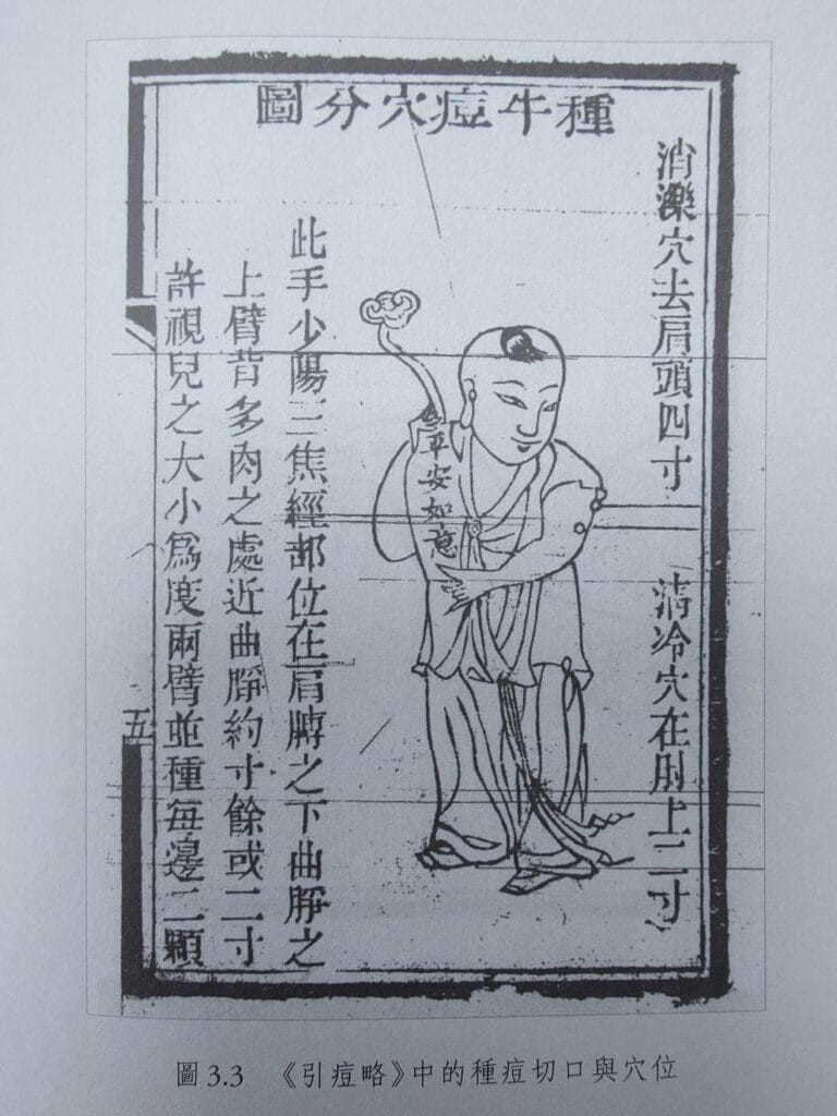 邱熺《引痘略》